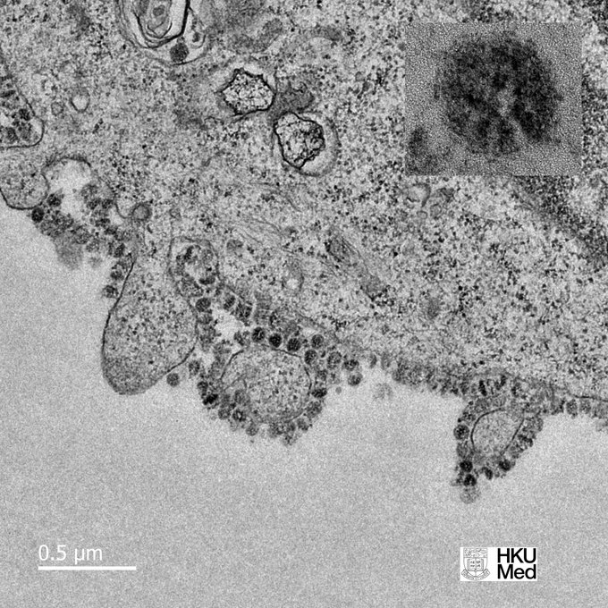 Thin section electron micrograph image of the SARS-CoV-2 novel coronavirus. Image credit: HKU Medicine